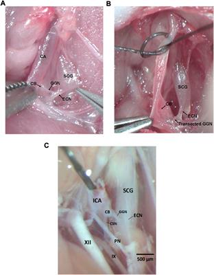 Loss of ganglioglomerular nerve input to the carotid body impacts the hypoxic ventilatory response in freely-moving rats